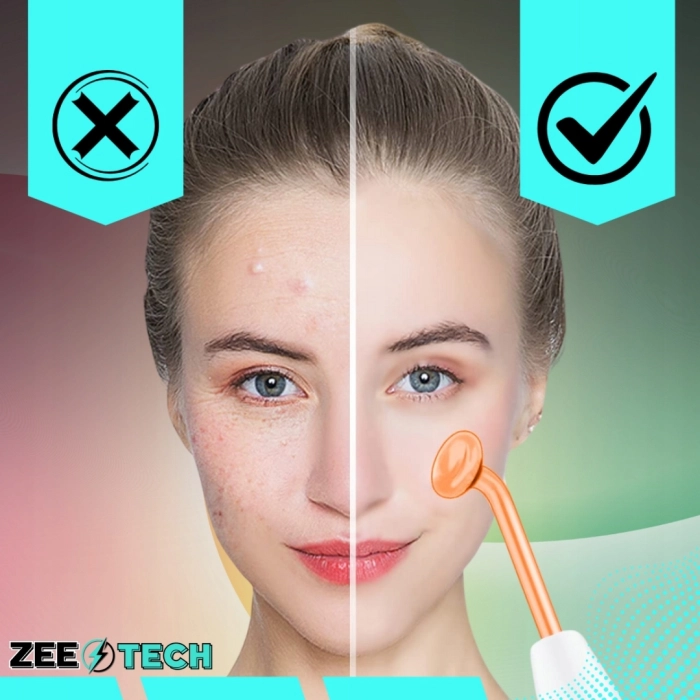 Darsonval Derma Wand 10W – 4 Elektrody – Pielęgnacja Twarzy, Skóry i Włosów