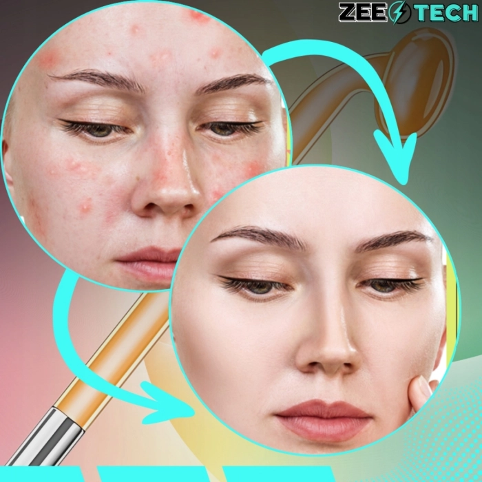 Darsonval Derma Wand 10W – 4 Elektrody – Pielęgnacja Twarzy, Skóry i Włosów