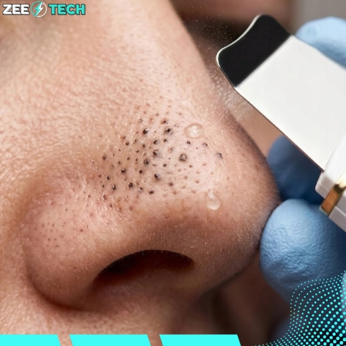 Urządzenie do peelingu kawitacyjnego 3w1 – oczyszczanie twarzy ultradźwiękowe, jonoforeza i sonoforeza, lifting i regeneracja skóry